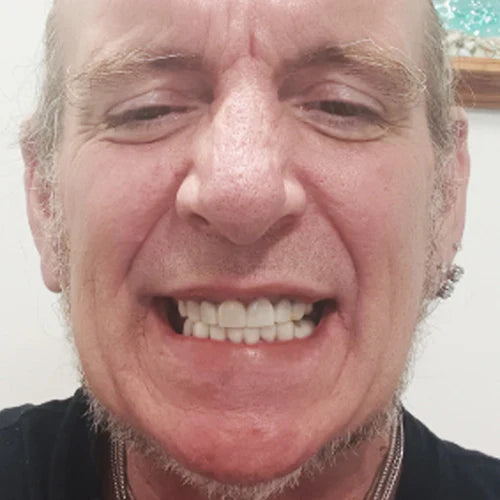 Sourire Clipse 3