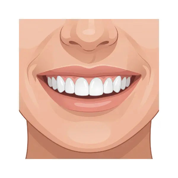 Étape 3 sourire